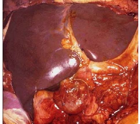 Normal Human Liver